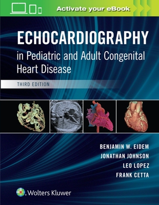 【预订】Echocardiography in Pediatric and Adult Congenital Heart Disease