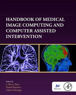 Computing Intervention Handbook Assisted Computer and Image Medical 预订