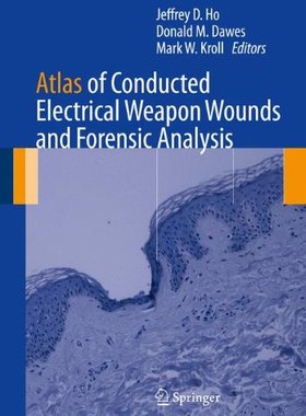 【预订】Atlas of Conducted Electrical Weapon Wounds and Forensic Analysis