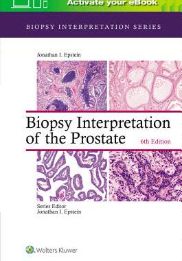 【预订】Biopsy Interpretation of the Prostate