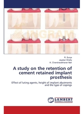 预订 A Study on the Retention of Cement Retained Implant Prosthesis: 9783659417207