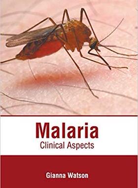 【预售】Malaria: Clinical Aspects