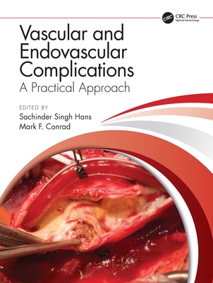 【预订】Vascular and Endovascular Complications: A Practical Approach