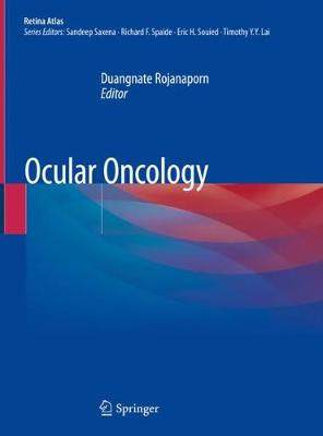 【预订】Ocular Oncology