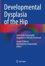 【预订】Developmental Dysplasia of the Hip 9783030949556