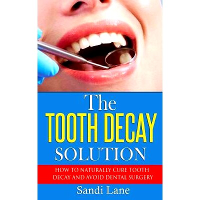 预订 The Tooth Decay Solution: How to Naturally Cure Tooth Decay and Avoid Dental Surgery: 9781533243829