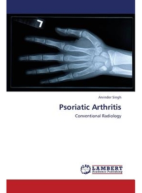 预订 Psoriatic Arthritis: 9783659431364