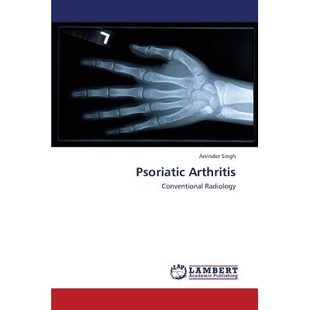 预订 Psoriatic Arthritis: 9783659431364