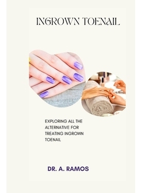 预订 Ingrown Toenail: Exploring All the Alternative for Treating Ingrown Toenail: 9798878963909