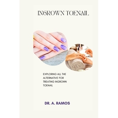 预订 Ingrown Toenail: Exploring All the Alternative for Treating Ingrown Toenail: 9798878963909
