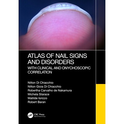 预订 Atlas of Nail Signs and Disorders with Clinical and Onychoscopic Correlation 指甲标志与疾病及临床与皮肤镜学相关性图