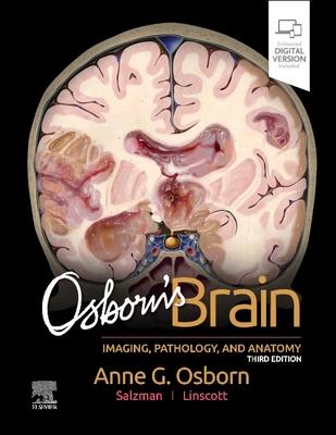 [预订]Osborn’s Brain 9780443109379 书籍/杂志/报纸 科学技术类原版书 原图主图