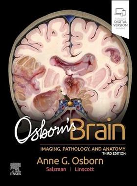 [预订]Osborn’s Brain 9780443109379