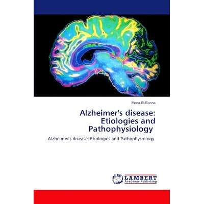 预订 Alzheimer’s disease: Etiologies and Pathophysiology: 9786208222864