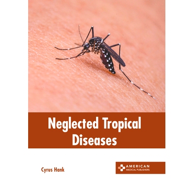 预订 Neglected Tropical Diseases: 9798887402963