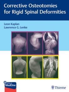 [预订]Corrective Osteotomies For Rigid Spinal Deformities 9783131730817