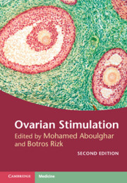 【预订】Ovarian Stimulation 9781107135970