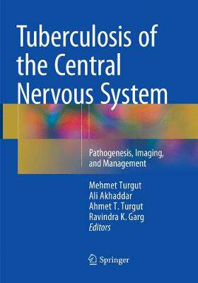 预订 Tuberculosis of the Central Nervous System