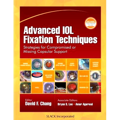 Strategies for Compromised or Missing Ca