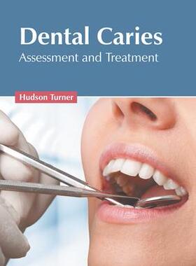 [预订]Dental Caries: Assessment and Treatment 9781639891481