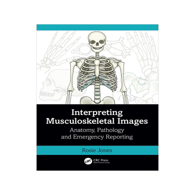 [预订]Interpreting Musculoskeletal Images 9781032398914