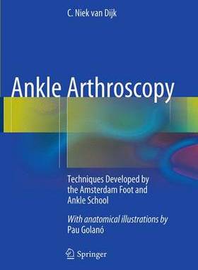 预订 Ankle Arthroscopy