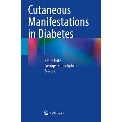 预订 Cutaneous Manifestations in Diabetes 糖尿病的皮肤表现 9783031653025