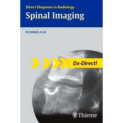 预订 Spinal Imaging: Direct Diagnosis in Radiology 脊柱成像: 9783131440716