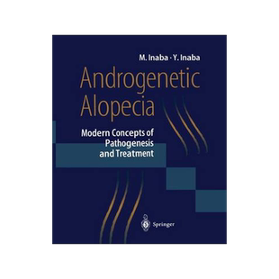 预订 Androgenetic Alopecia