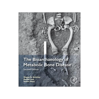 [预订]The Bioarchaeology of Metabolic Bone Disease 9780081010204