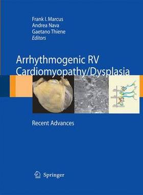 预订 Arrhythmogenic RV Cardiomyopathy/Dysplasia