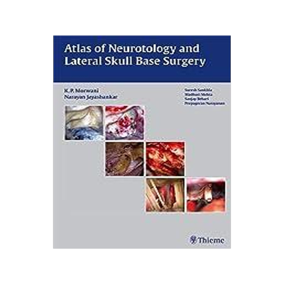 [预订]Atlas of Neurotology and Lateral Skull Base Surgery 9789382076933