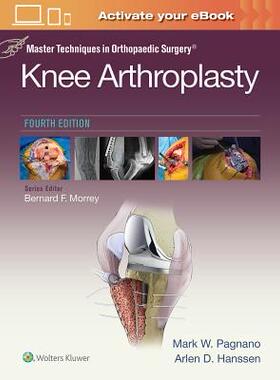 【预订】Master Techniques in Orthopedic Surgery