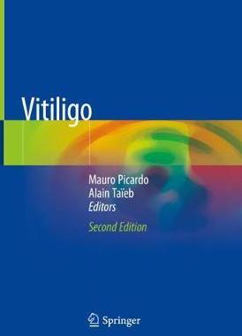 【预订】Vitiligo