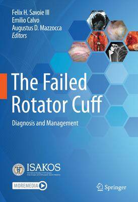 [预订]The Failed Rotator Cuff 9783030794804