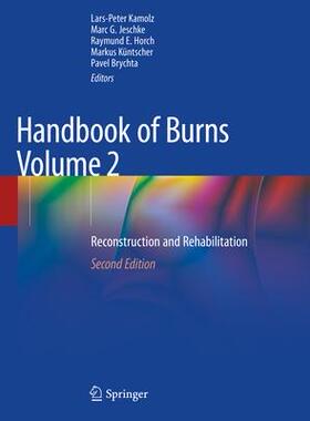 [预订]Handbook of Burns Volume 2 9783030345136