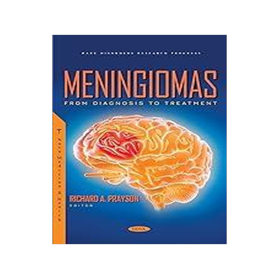 [预订]Meningiomas: From Diagnosis to Treatment 9781685077150