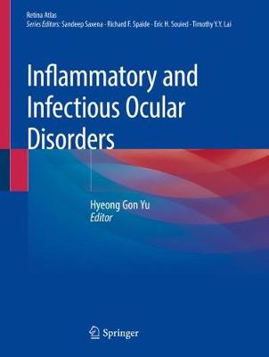 【预订】Inflammatory and Infectious Ocular Disorders 9789811385483