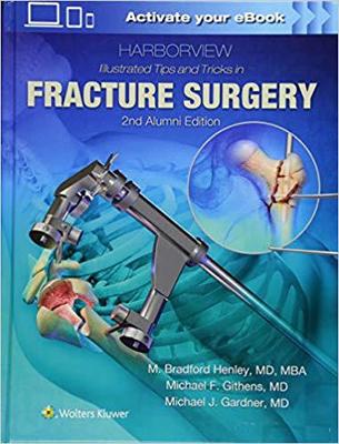 【预订】Harborview Illustrated Tips and Tricks in Fracture Surgery