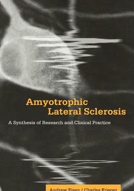 【预订】Amyotrophic Lateral Sclerosis