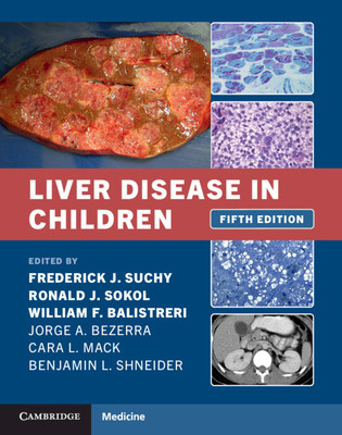 【预订】Liver Disease in Children