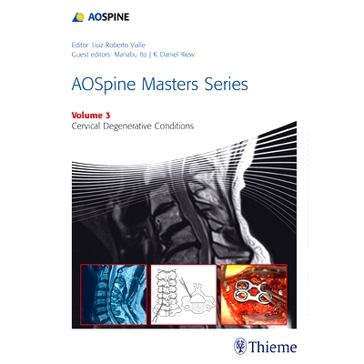 Cervical Degenerative Conditions