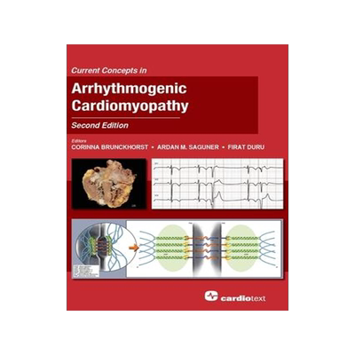 [预订]Current Concepts in Arrhythmogenic Cardiomyopathy, Second Edition 9781942909507