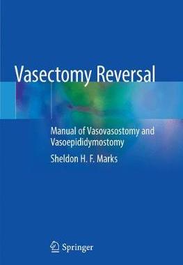 预订 Vasectomy Reversal
