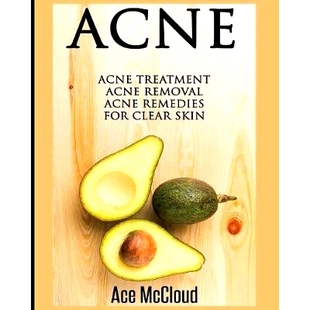 预订 Acne: Acne Treatment: Acne Removal: Acne Remedies For Clear Skin: 9781640481268