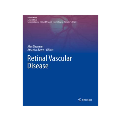 [预订]Retinal Vascular Disease 9789811540776