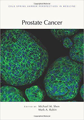 【预售】prostate cancer