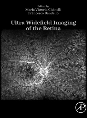 预订 Ultra Widefield Imaging of the Retina 视网膜超广角成像: 9780443290848