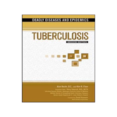 [预订]Tuberculosis 9781617530173
