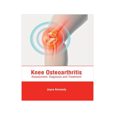 [预订]Knee Osteoarthritis: Assessment, Diagnosis and Treatment 9781646471010